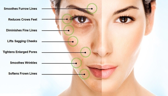 EINECS 232-678-0 ผงกรดไฮยาลูโรนิก 2000- 5000 Dalton Pure Hyaluronic Acid Serum ผง